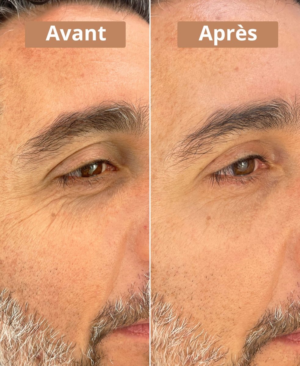 Sérum contour des yeux - GreenBerry Comme Avant